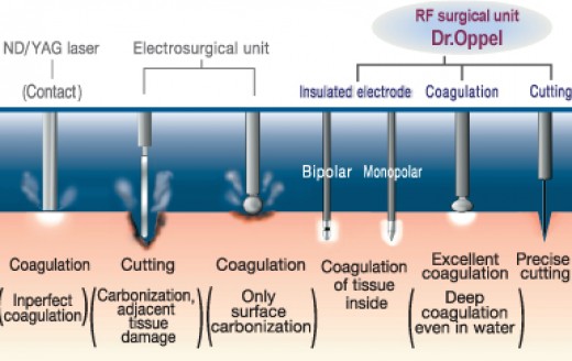 Dr.Oppel Radio Frequency Generator